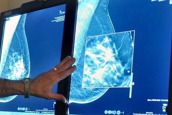 Hallado en corales blandos un compuesto prometedor contra el cáncer