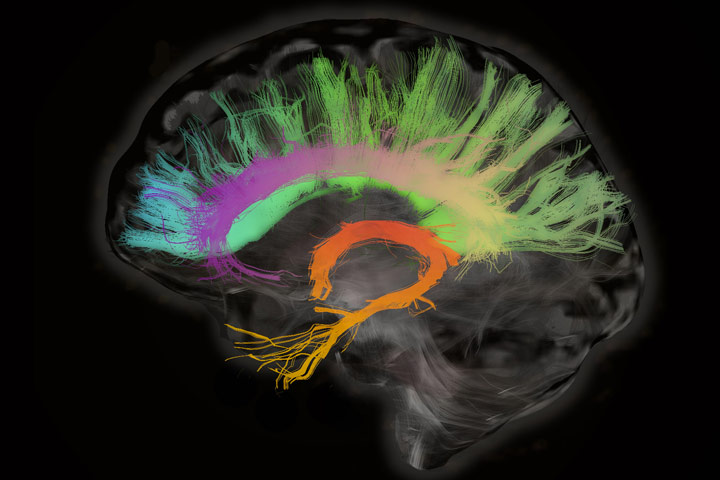 Estimulación cerebral para combatir la pérdida de memoria en la vejez