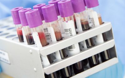 Variación de la hemoglobina en pacientes sometidos a liposucción. Estudio en clínica de Pereira